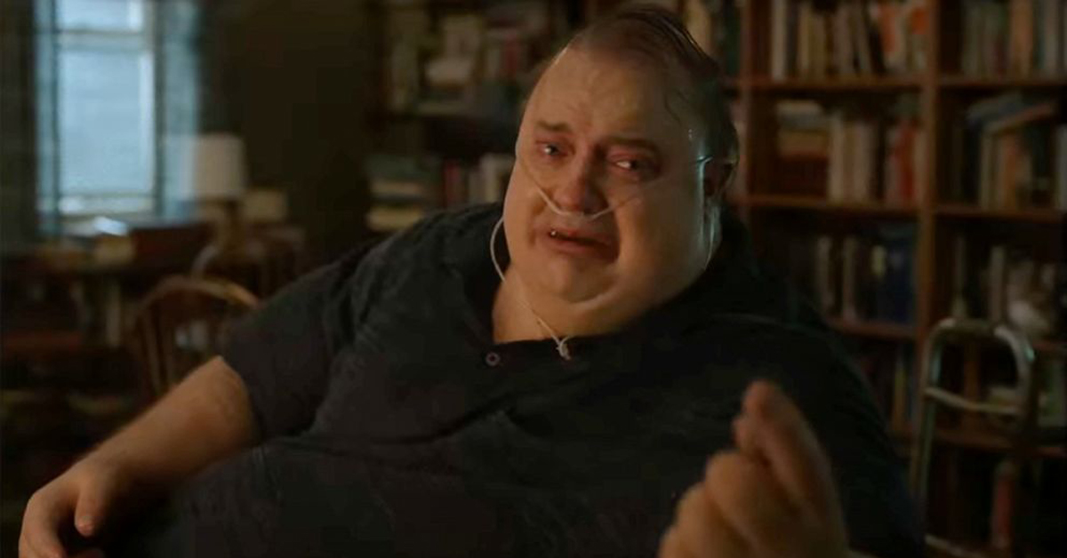 An obese man reaching out for help.